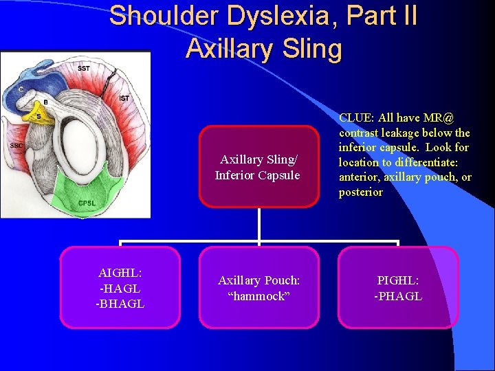 Shoulder Dyslexia, Part II Axillary Sling/ Inferior Capsule AIGHL: -HAGL -BHAGL Axillary Pouch: “hammock”