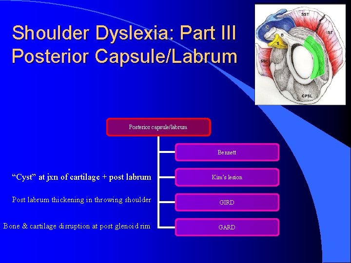Shoulder Dyslexia: Part III Posterior Capsule/Labrum Posterior capsule/labrum Bennett “Cyst” at jxn of cartilage