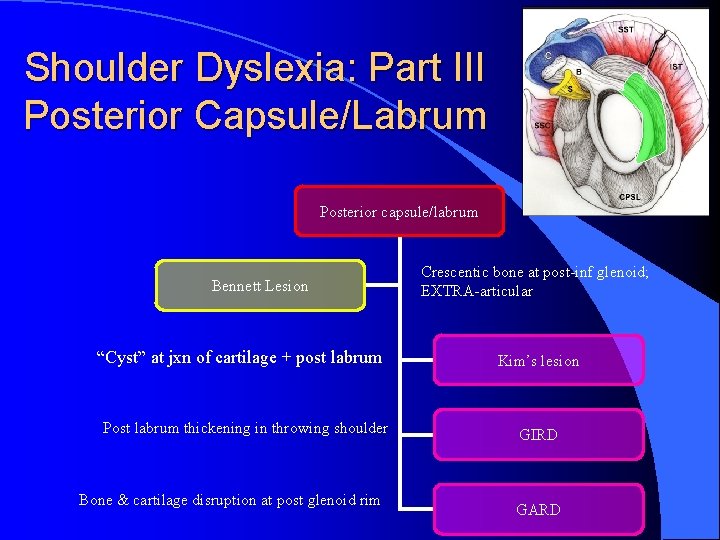 Shoulder Dyslexia: Part III Posterior Capsule/Labrum Posterior capsule/labrum Bennett Lesion “Cyst” at jxn of