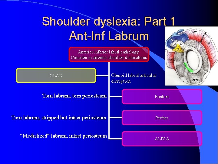 Shoulder dyslexia: Part 1 Ant-Inf Labrum Anterior inferior labral pathology: Consider in anterior shoulder