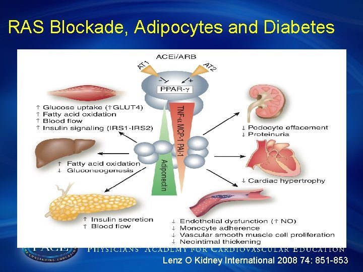RAS Blockade, Adipocytes and Diabetes Lenz O Kidney International 2008 74: 851 -853 