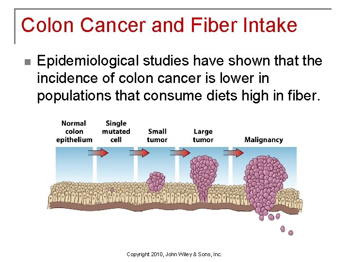 Colon Cancer and Fiber Intake n Epidemiological studies have shown that the incidence of