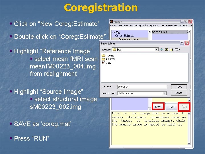 Coregistration § Click on “New Coreg: Estimate” § Double-click on “Coreg: Estimate” § Highlight