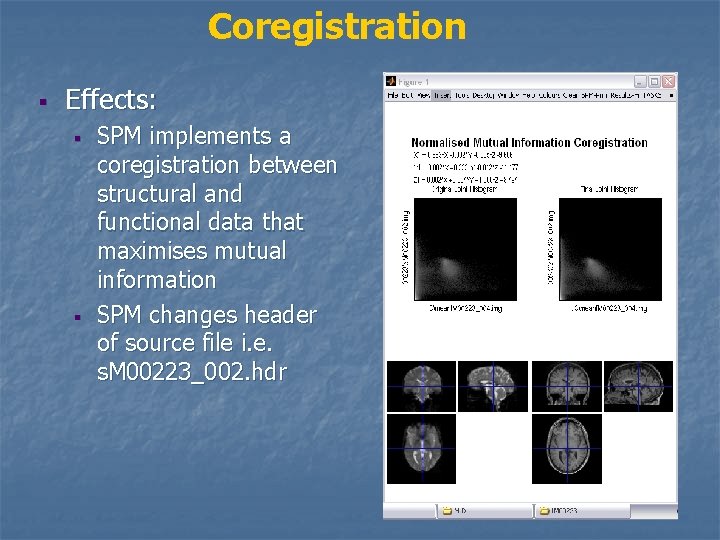 Coregistration § Effects: § § SPM implements a coregistration between structural and functional data