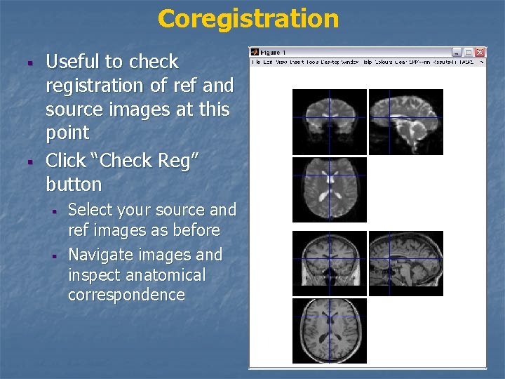 Coregistration § § Useful to check registration of ref and source images at this