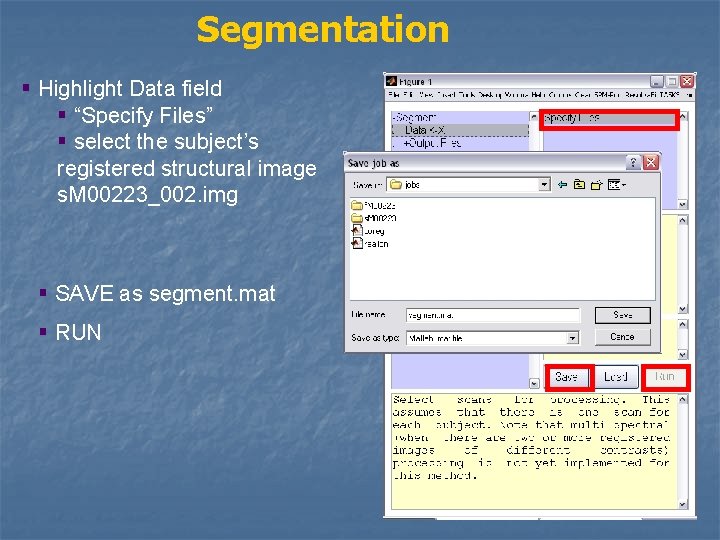 Segmentation § Highlight Data field § “Specify Files” § select the subject’s registered structural