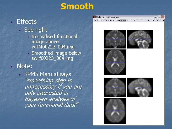 Smooth § Effects § See right § § § Normalised functional image above wrf.