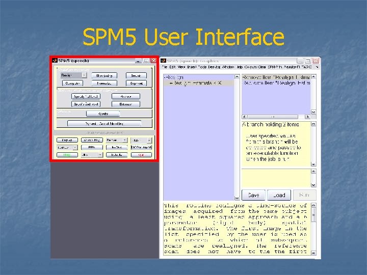 SPM 5 User Interface 
