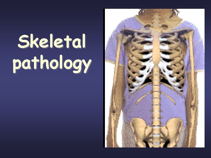 Skeletal pathology 