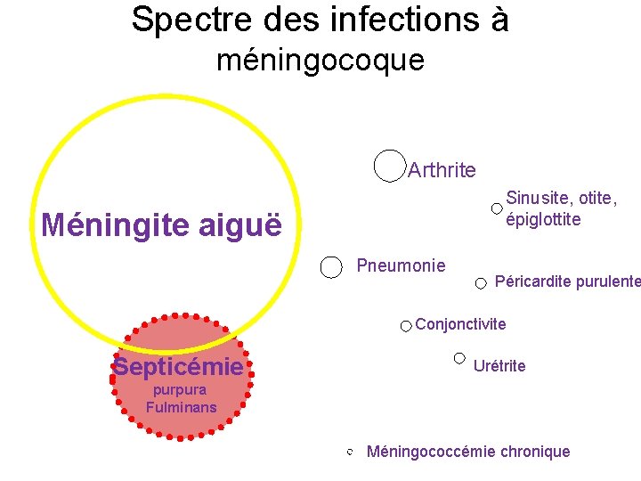 Spectre des infections à méningocoque Arthrite Sinusite, otite, épiglottite Méningite aiguë Pneumonie Péricardite purulente