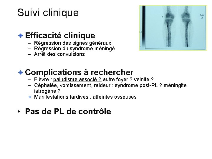 Suivi clinique Efficacité clinique – Régression des signes généraux – Régression du syndrome méningé