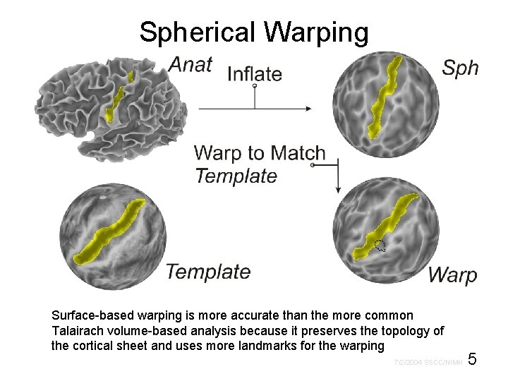 Spherical Warping Surface-based warping is more accurate than the more common Talairach volume-based analysis