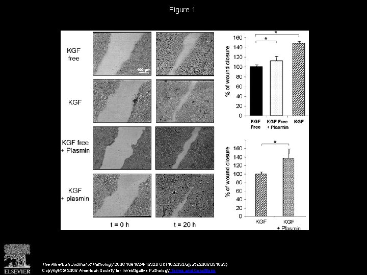 Figure 1 The American Journal of Pathology 2006 1691624 -1632 DOI: (10. 2353/ajpath. 2006.