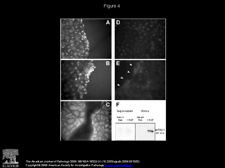 Figure 4 The American Journal of Pathology 2006 1691624 -1632 DOI: (10. 2353/ajpath. 2006.