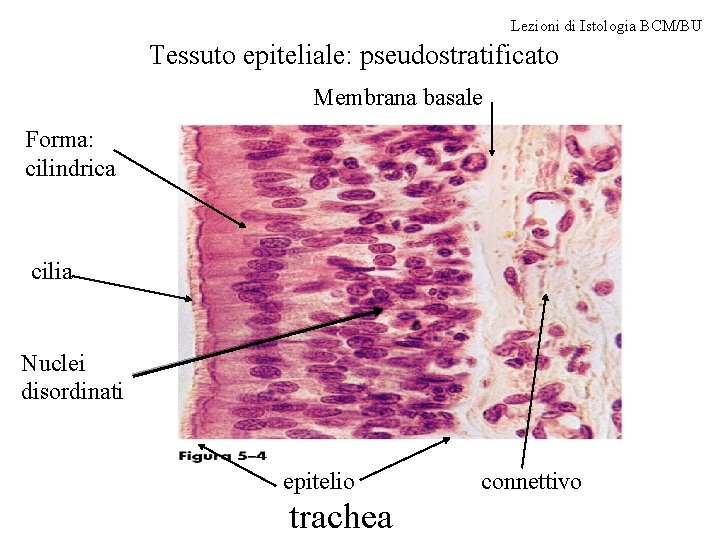 Lezioni di Istologia BCM/BU Tessuto epiteliale: pseudostratificato Membrana basale Forma: cilindrica cilia Nuclei disordinati