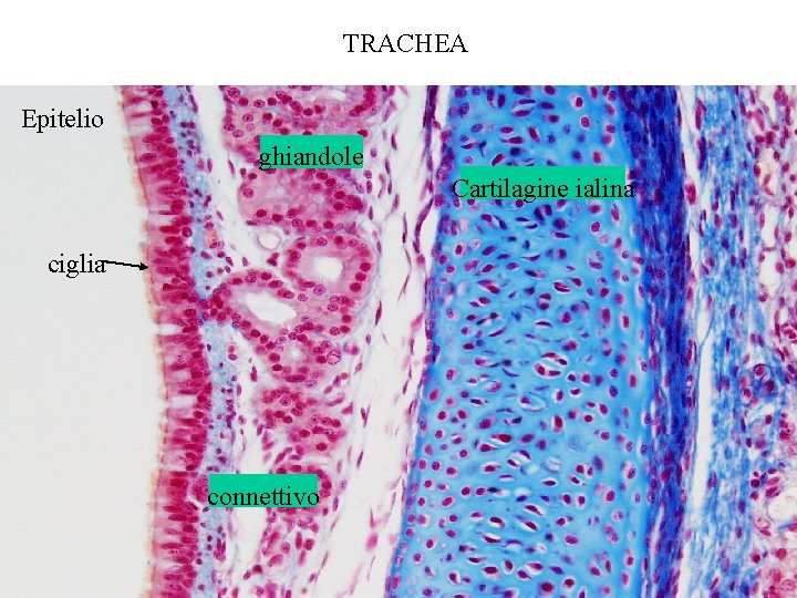 TRACHEA Epitelio ghiandole Cartilagine ialina ciglia connettivo 