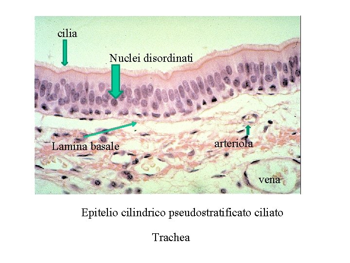 cilia Nuclei disordinati arteriola Lamina basale vena Epitelio cilindrico pseudostratificato ciliato Trachea 