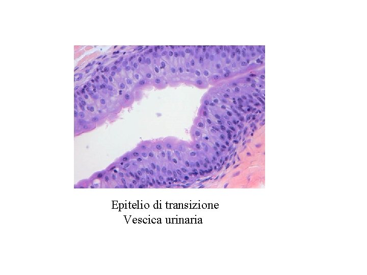 Epitelio di transizione Vescica urinaria 