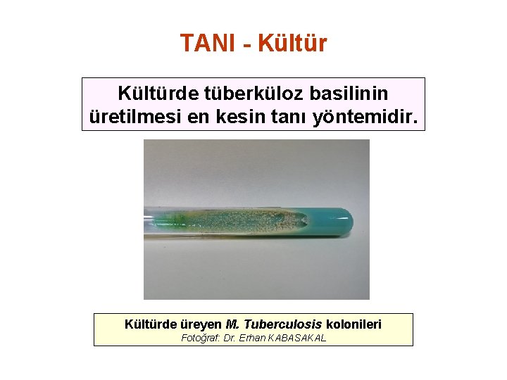 TANI - Kültürde tüberküloz basilinin üretilmesi en kesin tanı yöntemidir. Kültürde üreyen M. Tuberculosis