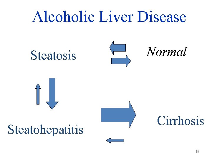 Alcoholic Liver Disease Steatosis Steatohepatitis Normal Cirrhosis 19 