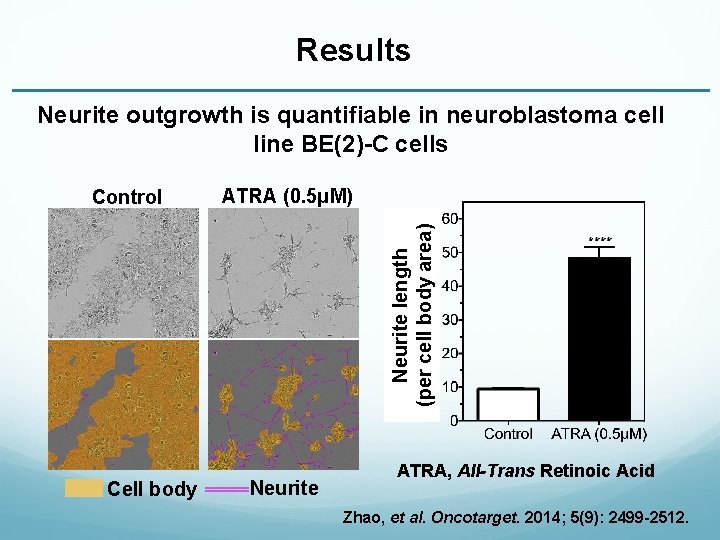 Results Neurite outgrowth is quantifiable in neuroblastoma cell line BE(2)-C cells ATRA (0. 5μM)