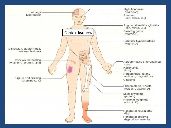 Clinical features 