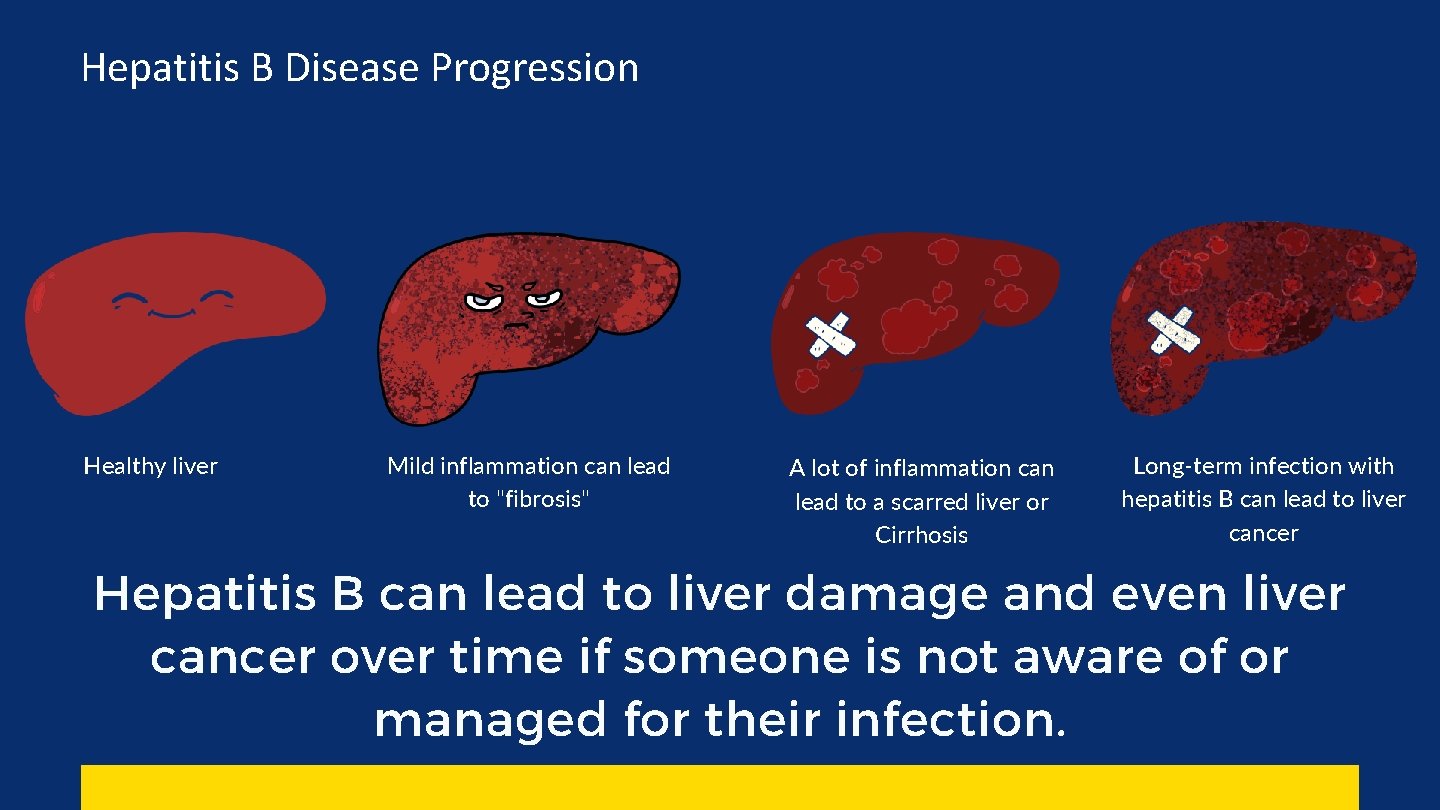 Hepatitis B Disease Progression Healthy liver Mild inflammation can lead to "fibrosis" A lot