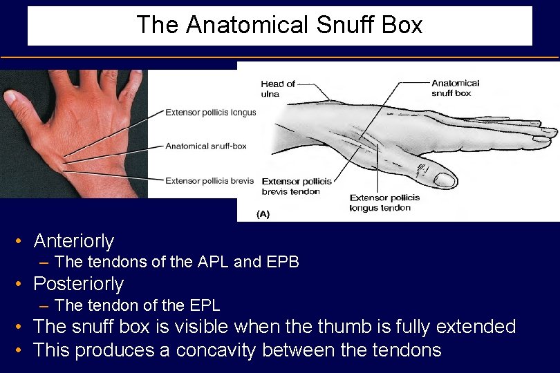 The Anatomical Snuff Box • Anteriorly – The tendons of the APL and EPB