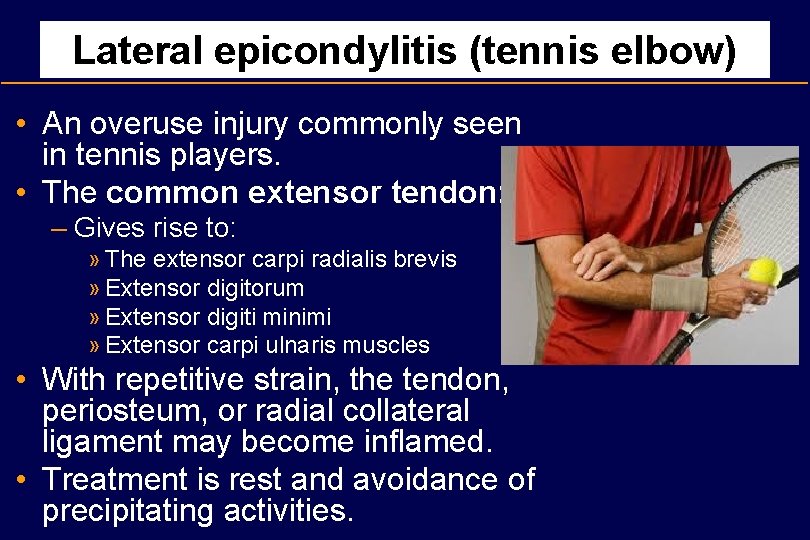 Lateral epicondylitis (tennis elbow) • An overuse injury commonly seen in tennis players. •
