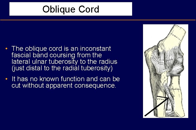 Oblique Cord • The oblique cord is an inconstant fascial band coursing from the