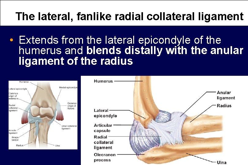 The lateral, fanlike radial collateral ligament • Extends from the lateral epicondyle of the