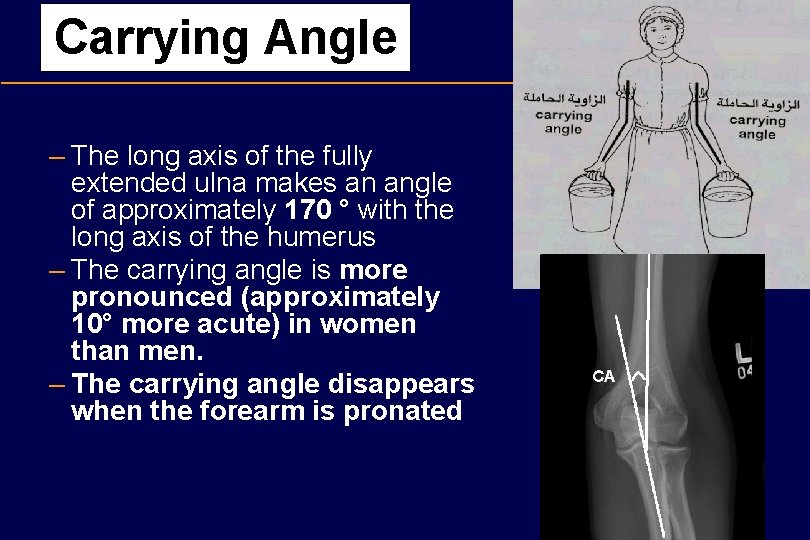Carrying Angle – The long axis of the fully extended ulna makes an angle