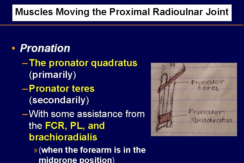 Muscles Moving the Proximal Radioulnar Joint • Pronation – The pronator quadratus (primarily) –