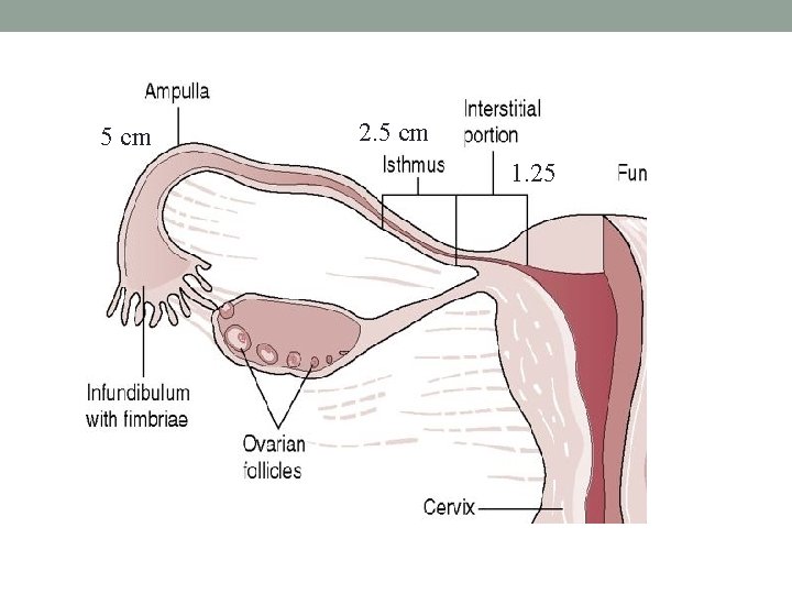 5 cm 2. 5 cm 1. 25 