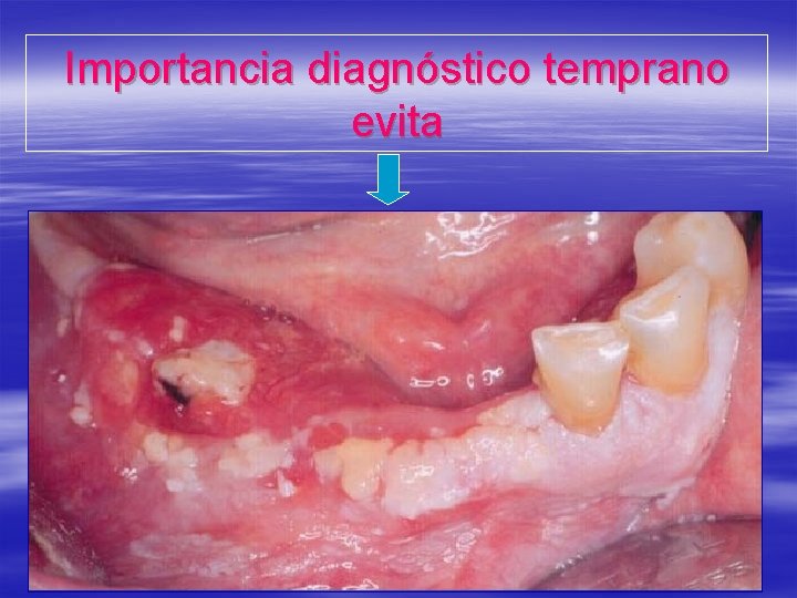 Importancia diagnóstico temprano evita 