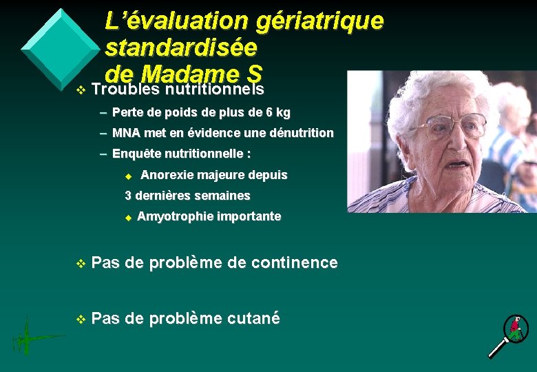 L’évaluation gériatrique standardisée de Madame S v Troubles nutritionnels – Perte de poids de
