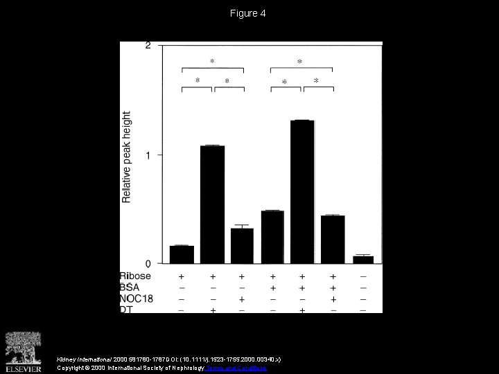 Figure 4 Kidney International 2000 581780 -1787 DOI: (10. 1111/j. 1523 -1755. 2000. 00340.