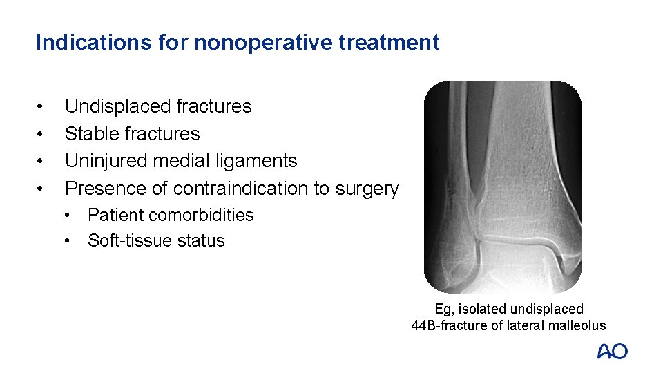Indications for nonoperative treatment • • Undisplaced fractures Stable fractures Uninjured medial ligaments Presence
