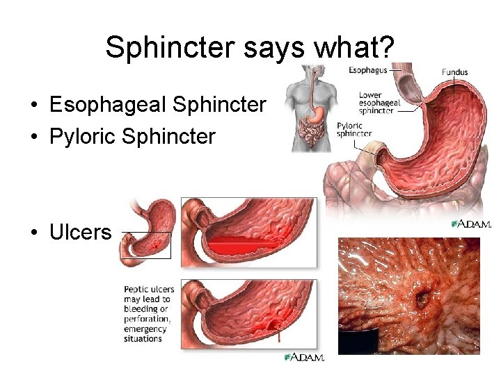 Sphincter says what? • Esophageal Sphincter • Pyloric Sphincter • Ulcers 