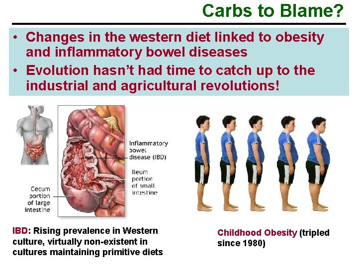 Carbs to Blame? • Changes in the western diet linked to obesity and inflammatory