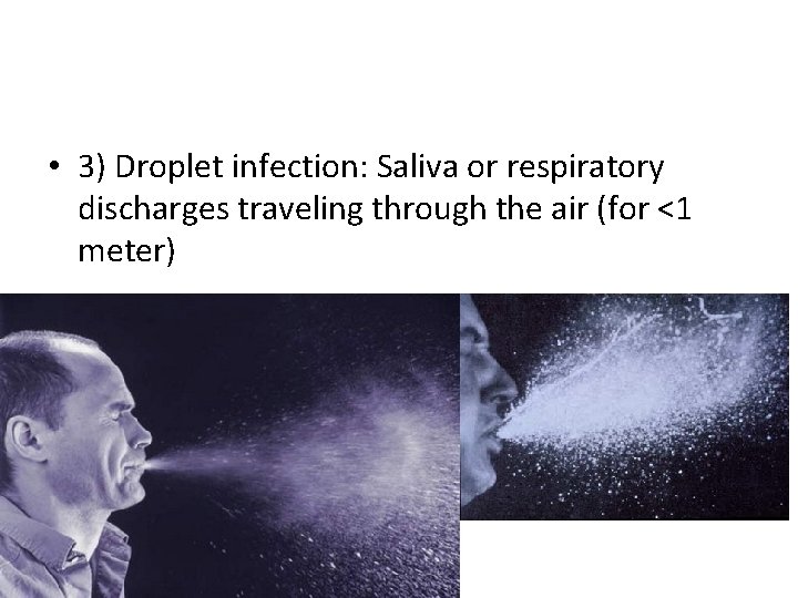  • 3) Droplet infection: Saliva or respiratory discharges traveling through the air (for
