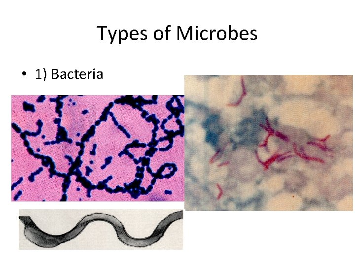 Types of Microbes • 1) Bacteria 
