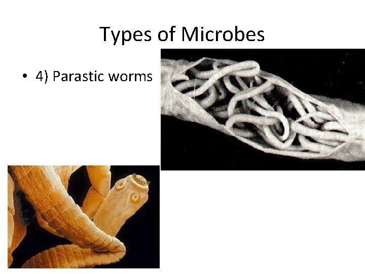 Types of Microbes • 4) Parastic worms 