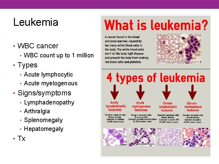 Leukemia • WBC cancer • WBC count up to 1 million • Types •