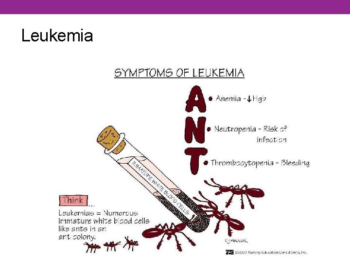 Leukemia 
