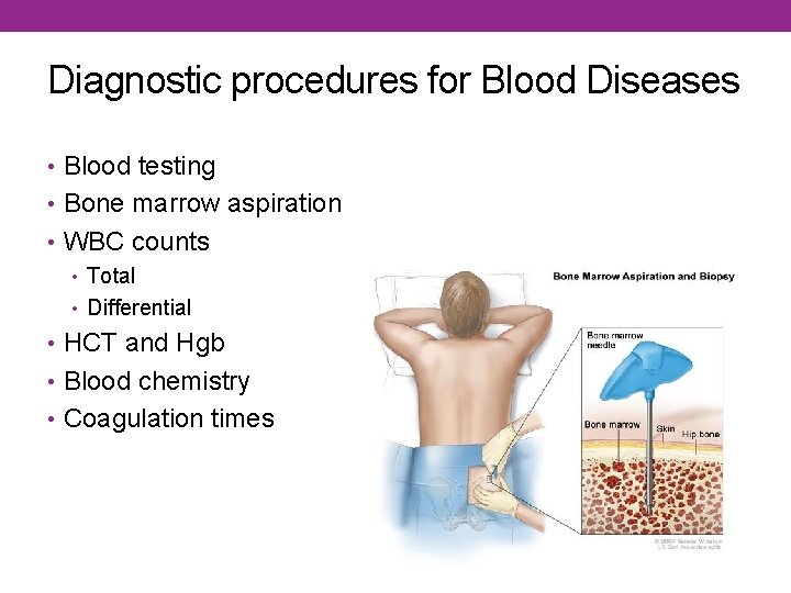 Diagnostic procedures for Blood Diseases • Blood testing • Bone marrow aspiration • WBC