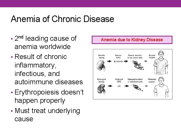 Anemia of Chronic Disease • 2 nd leading cause of anemia worldwide • Result