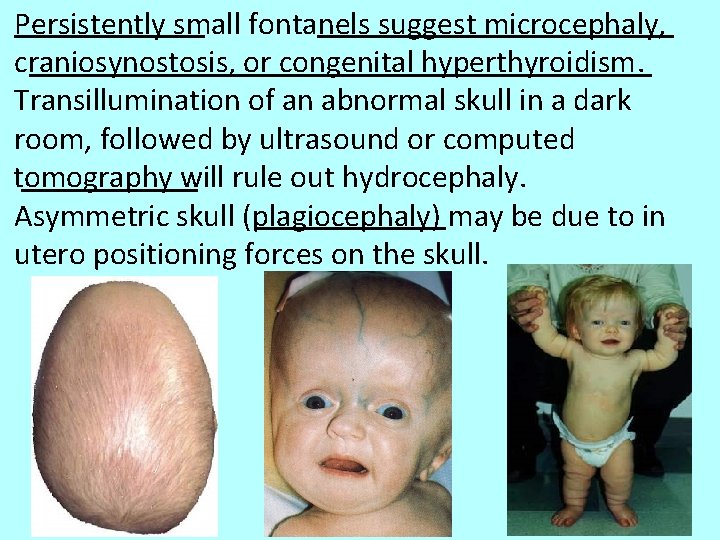 Persistently small fontanels suggest microcephaly, craniosynostosis, or congenital hyperthyroidism. Transillumination of an abnormal skull