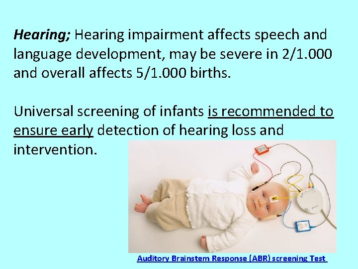 Hearing; Hearing impairment affects speech and language development, may be severe in 2/1. 000