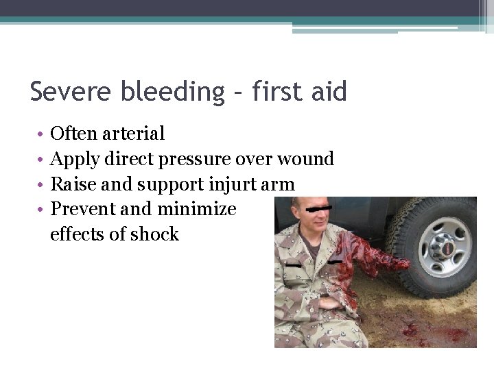 Severe bleeding – first aid • • Often arterial Apply direct pressure over wound